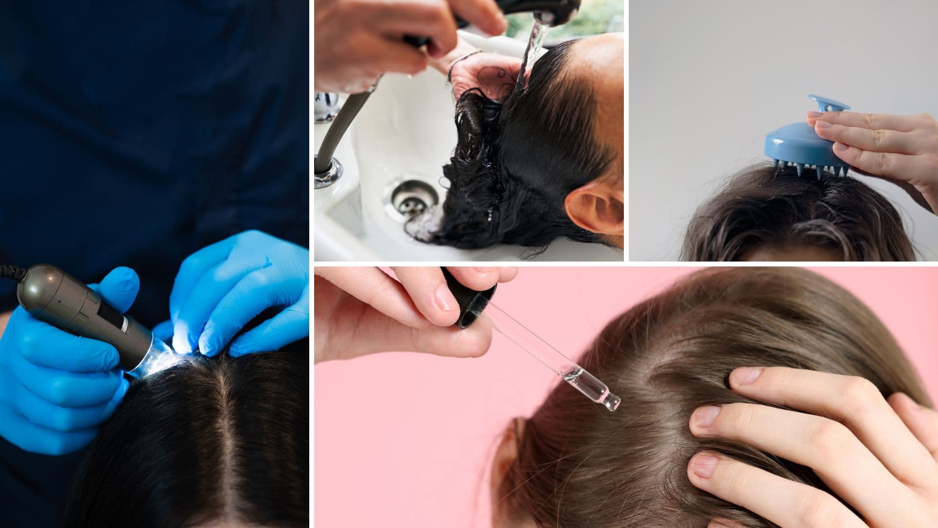 頭皮護理特色圖片